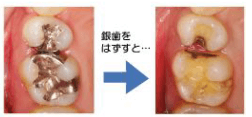 審美歯科１