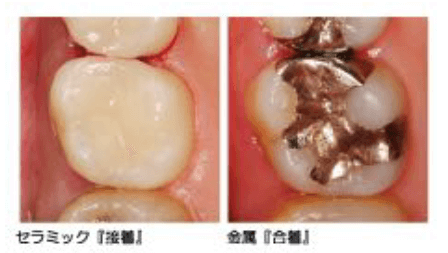 審美歯科３